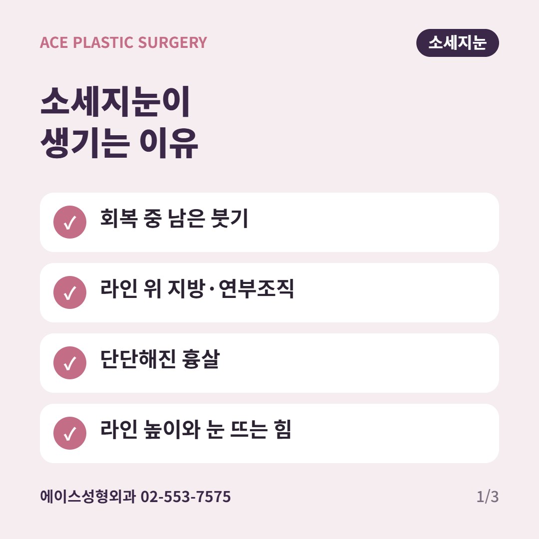 소세지눈이 생기는 주요 원인 요약 카드: 붓기, 지방, 흉살, 라인 높이