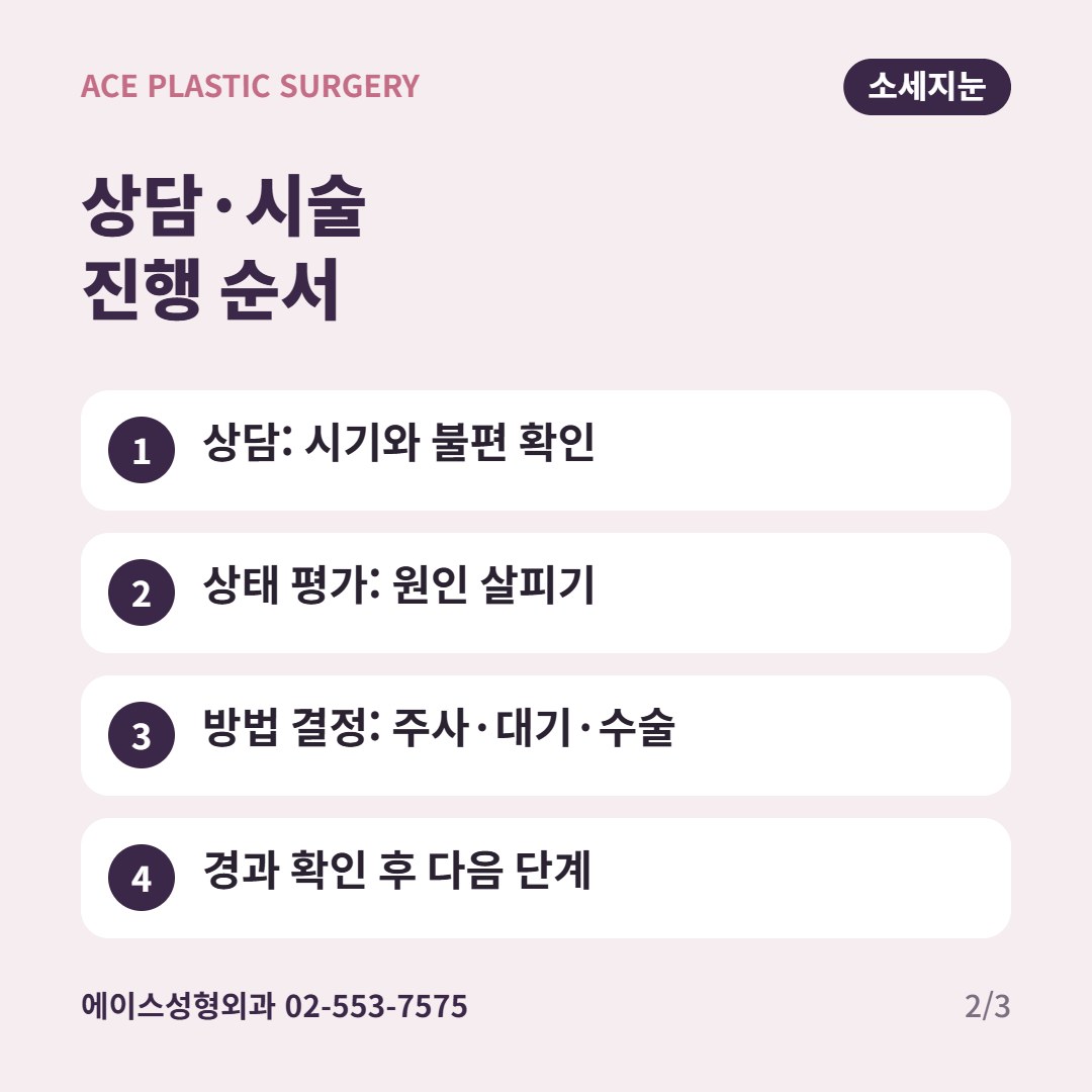 소세지눈 상담과 시술 진행 순서 카드: 상담, 상태 평가, 방법 결정, 경과 확인